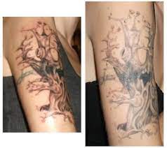 Pico lasers were initially used in tattoo removal, to optimize efficacy and reduce. My Experience Lightening And Removing My Tattoo At Home Tatring