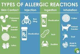 Allergies And Allergic Reactions Treatmet Migraine Relief Sinus Allergies Headache Prevention