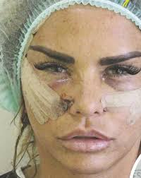 Efter plastikstoppet: opererar om sig till katt!