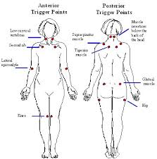 10 Elegant Fibromyalgia Tender Points Chart Images