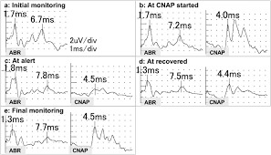 Cnap enforces reproducibility in both the application and the computing environment through required git integration and containerization. Intraoperative Abr And Cnap A B Abr Was Monitored Throughout The Download Scientific Diagram