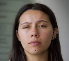 Las miradas rotas de las revueltas en Chile: “Sentí el impacto en el ojo,  caí al suelo... salía mucha sangre”