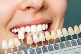 Benefits of Investing in Zirconia All-on-4 Implants