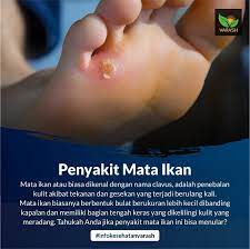 Translations of the phrase jari kaki from indonesian to english and examples of the use of jari kaki in a sentence with their translations: ðŒðšð­ðš ðˆð¤ðšð§ Munculnya Penyakit Minyak Varash Herbal Oil Facebook