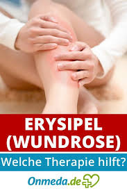 Erysipel Wundrose Ist Die Infektion Ansteckend Welche Therapie Hilft Onmeda De Ganzheitliche Gesundheit Gesundheit Krankheit