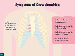 I have had an uncomfortable pressure on my left side just under my rib cage for a few months now and have no clue what it is. Costochondritis Prevalence Symptoms Causes Diagnosis And Treatment
