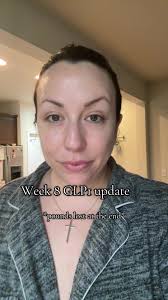 Changing my injection sight helped with symptoms so much!!! Ready for week  9! #semaglutideforweightloss #semaglutide #glp1 #glp1forweightloss  #postpartum #weightloss #sahm