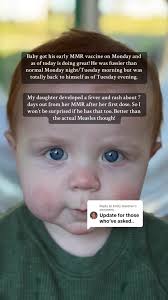 MMR Vaccine Experience: My Son's Journey