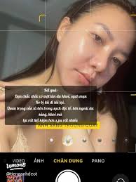 60 ý tưởng Mụn Tái Đi Tái Lại hàng đầu trong năm 2025