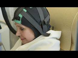 The fda has just approved a new study to test out a cap that can help cancer patients keep their hair. Cold Caps Reduce Chemotherapy Hair Loss Studies Show Youtube