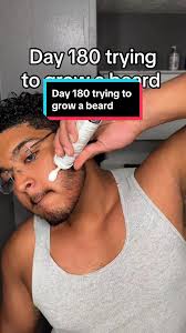Day 180 Beard Growth Progress