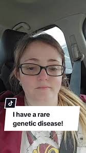 Er Brittle Bone Disease Episode