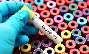 Additionally, what do high tumor markers mean? What Are Cancer Biomarkers And Why Are They Important Conquer The Patient Voice