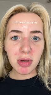 You Broke My Jaw Kayla Mace Og