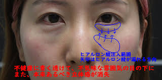 銀座・渋谷の美容外科 シンシア