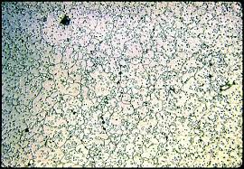 Image result for steel micrograph