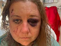 Fundraiser by Barbara Boyd : Support Niece's Healing and New Home Journey