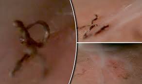 A woman in white underwear is holding a potted plant. This Is What Really Happens To Your Skin During Laser Hair Removal Express Co Uk