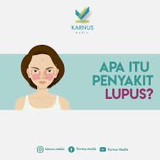 Penyakit ain adalah mata jahat , yaitu ketika orang yang memiliki kedengkian tingkat tinggi dari hatinya menyalurkan kedengkiannya ke orang atau bemda yang ia lihat melalui matanya , akibat dari rasa dengki itu adalah timbulnya rasa sakit pada. Jurnal Lupus