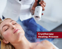 Image result for Cryotherapy