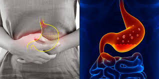 Penyakit yang menimbulkan sakit perut sebelah kiri atas.sakit perut sebelah kiri atas bisa disebabkan lantaran adanya masalah lambung seperti maag, tukak. Jika Anda Mengalami 5 Tanda Penyakit Gastrik Ini Dalam Badan Dapatkan Rawatan Segera