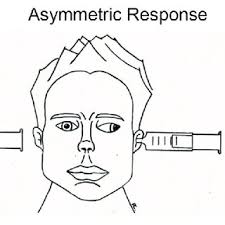 Image result for Oculovestibular Testing