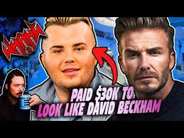 Plastic Surgery to Look Like David Beckham