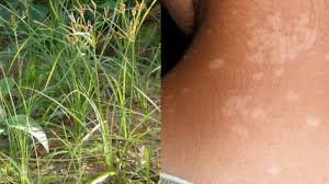 Check spelling or type a new query. Dikira Tak Berguna Rumput Teki Ternyata Solusi Macam Macam Penyakit Termasuk Basmi Panu Tribun Jabar