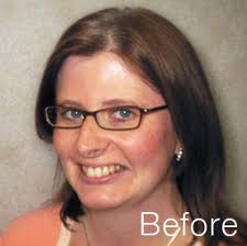 Grand Rapids Dentist Dr. Randall Chambers Satisfied Patients Before and  After