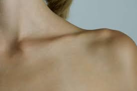The best way i can explain it is feels like when your pg and the. Symptoms And Treatment Of A Broken Collarbone