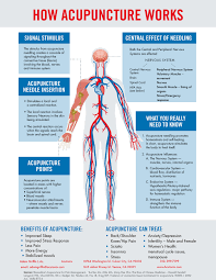 How Acupuncture Works Acutonix