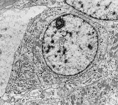 celula vista de uma microscopio eletronico microscopios microscopio optico eletronico