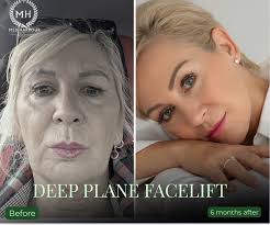 MedHarbour Thailand's #1 Plastic Surgery & Wellness Center