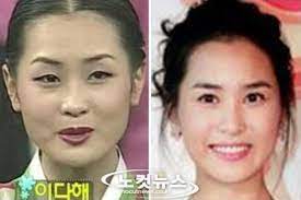 Lee da hae has undergone plastic sugery and this photo was published here on 30 july 2014 in the category plastic surgery. 13 Korean Celebrities Who Have Admitted To Plastic Surgery