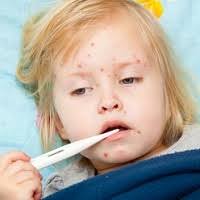 When to see a doctor about measles