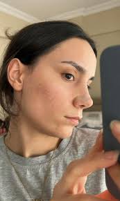 Best way to remove gel pad residue from wraps?