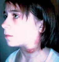 S l i d e 1 S l i d e 2 In today's presentation we will cover information  regarding the organism that causes tularemia and its