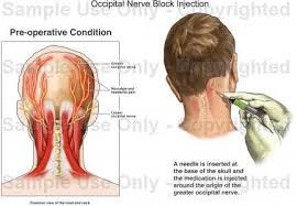 Pin On Procedures