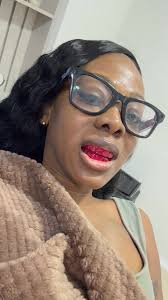 I went to Cali Columbia June 18th by myself. I did shave my teeth just a  little bit because I already liked my natural teeth, I just wanted them  perfected. I’m going to attach my tiktok link so you ...