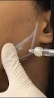 دكتور محمود فقيها -استشاري جراحة التجميل