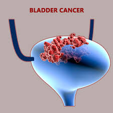 Is known to be one of the major diseases that affect being human is cancer, and virtually no leukemia rash pictures, signs, and symptoms | everyday health. Best Cancer Hospital In India Bladder Cancer Treatment In Coimbatore Tamil Nadu