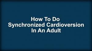 Image result for Synchronized Cardioversion