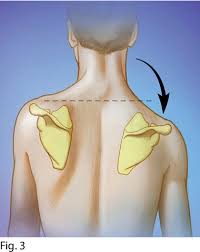 Image result for Winged Scapula