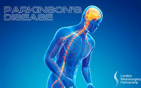 Treatment of depressive symptoms in parkinson's disease. Parkinson S Disease London Neurosurgery Partnership