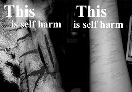 Also check out these quotes about self harm that will help move you to a calm moment. Quotes About Self Injury 46 Quotes