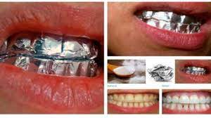 This is why teeth whitening treatment has grown in popularity over the years. This Is What Happens When You Wrap Your Teeth In Aluminum Foil For 1 Hour I Creative Ideas