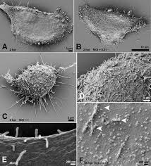 What does an electron look like under a microscope. Ultrastructural Analysis Of Sars Cov 2 Interactions With The Host Cell Via High Resolution Scanning Electron Microscopy Scientific Reports
