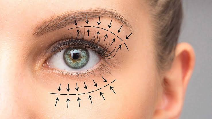 Debunking Common Myths About Blepharoplasty | The Clinic Holland Park |  Journal | August 16, 2023