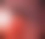 Image result for Colonoscopy in GI Bleeding