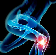 Osteoarthritis of the spine refers to inflammation of the spinal facet joints. Arthrose Symptome Diagnose Behandlung Welt